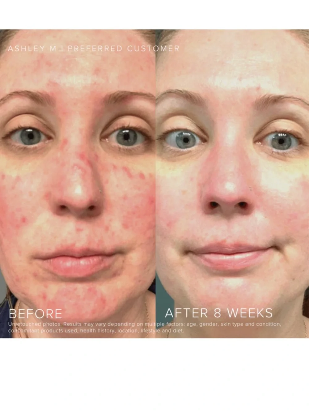 Rodan + Fields rodan fields